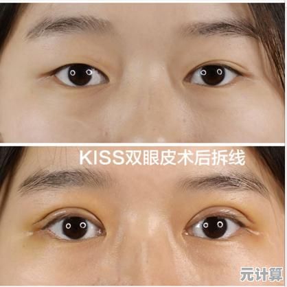 单眼皮如何自然变成双眼皮？这些有效方法值得尝试